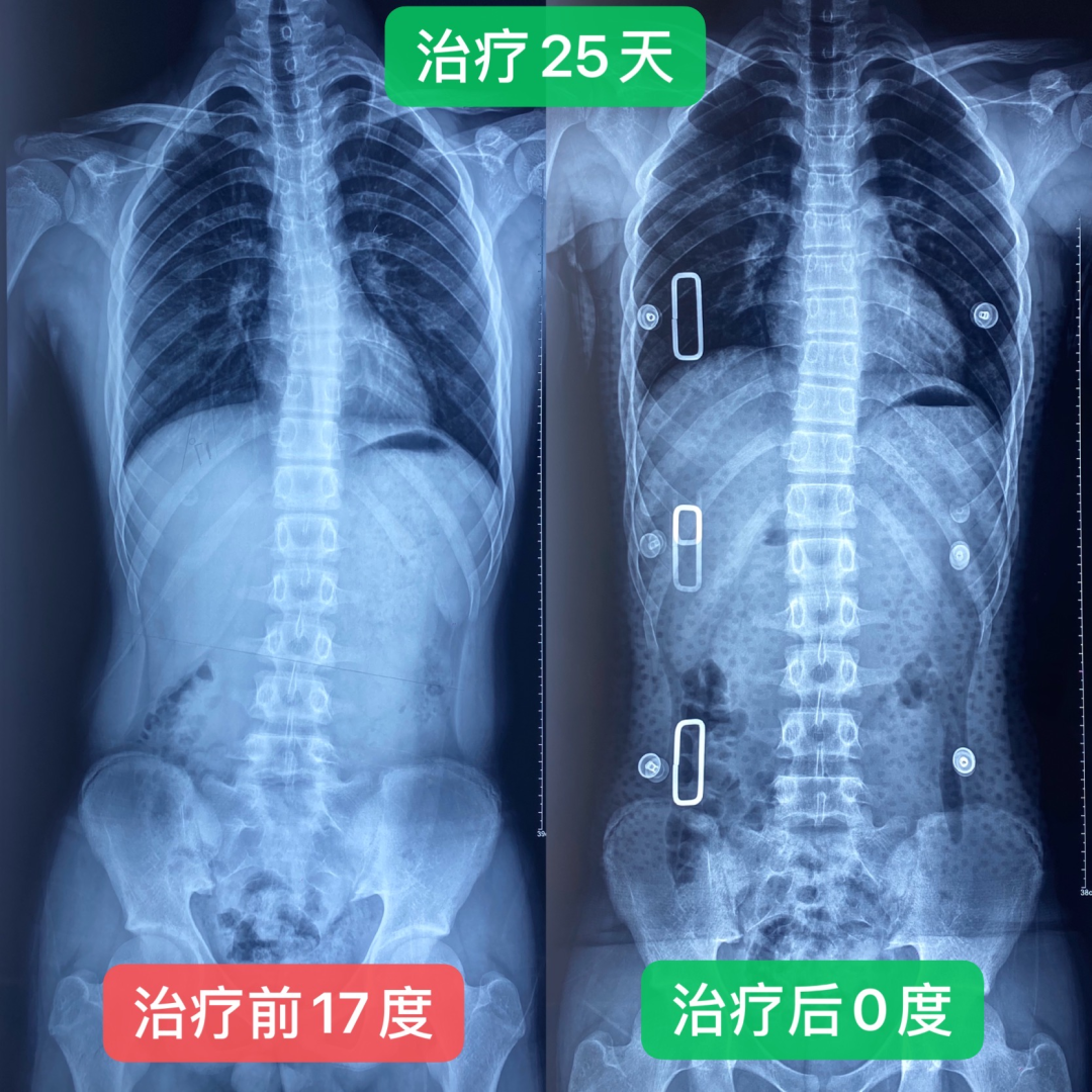 15岁少年军人梦差点被破灭，凶手竟然是它！