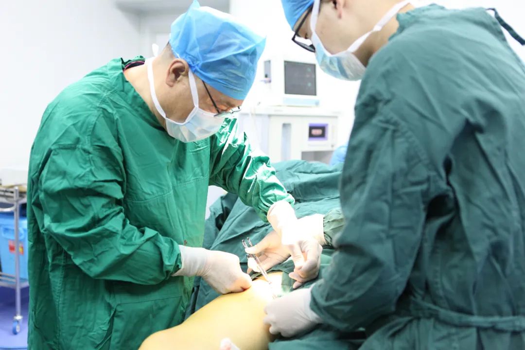 大隐静脉曲张拖延十余年丨30分钟，1根1mm光纤管子解决问题