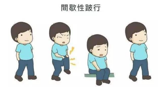 为什么腰椎管狭窄患者腿疼得走路寸步难行，却可以骑车行千里？