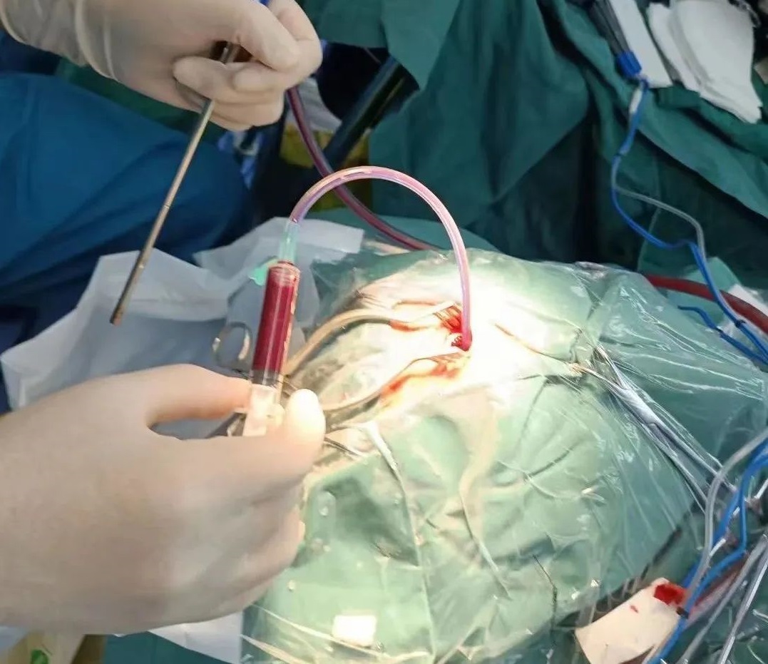 抢救纪实丨&ldquo;拯救大脑&rdquo;陕西冶金医院脑卒中绿色通道挽救患者生命