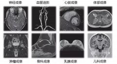 做磁共振检查之前，这6个事项要注意！
