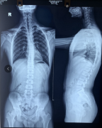 15岁少年军人梦差点被破灭，凶手竟然是它！